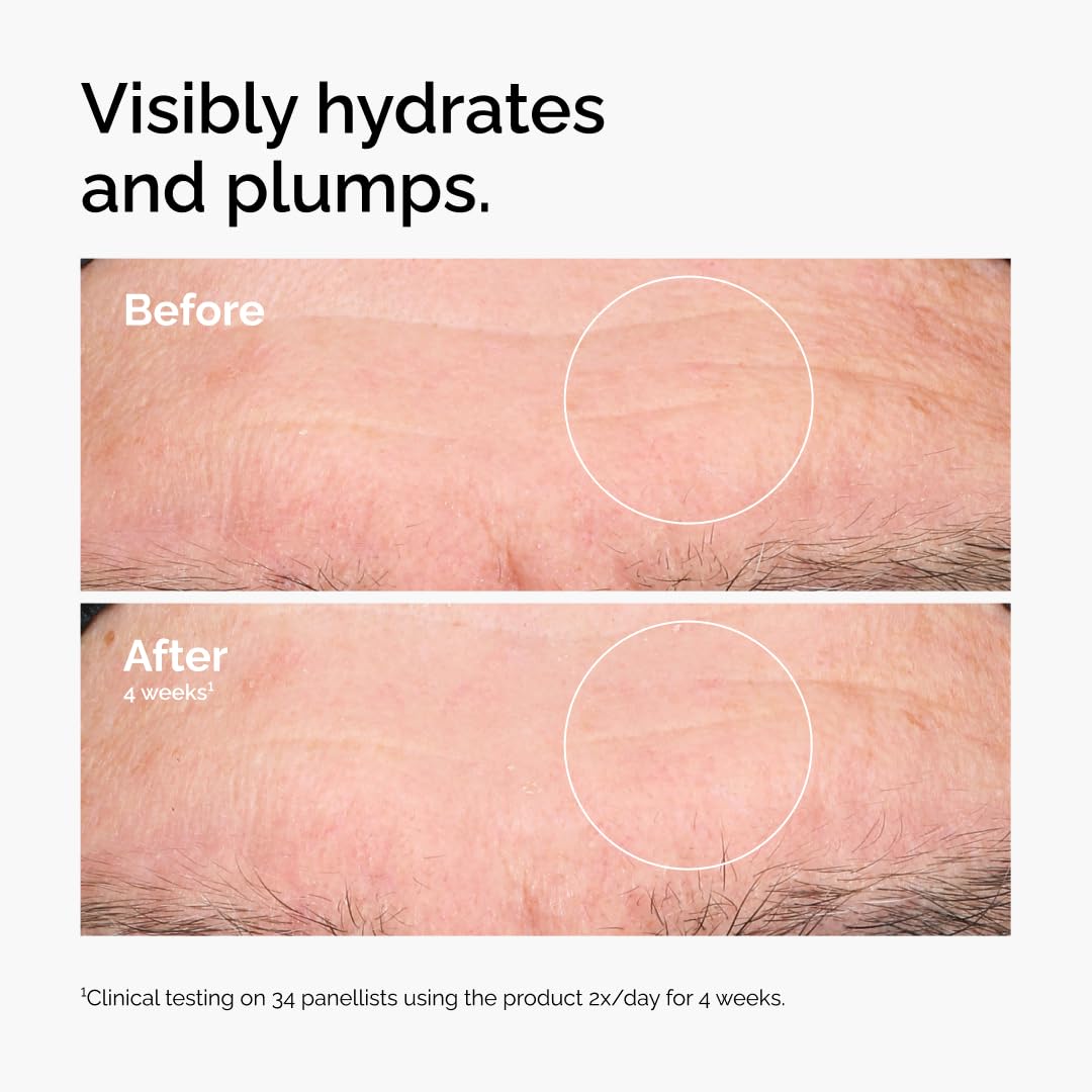 The Ordinary Hyaluronic Acid 2% + B5 (with Ceramides), Multi-Depth Hydration Serum for Plumper, Smoother Skin